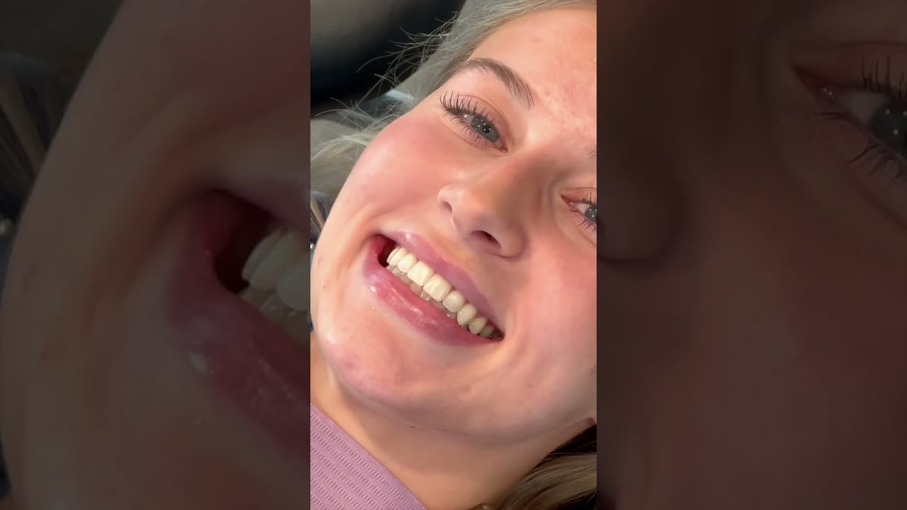 How Braces Are Removed BracesOff