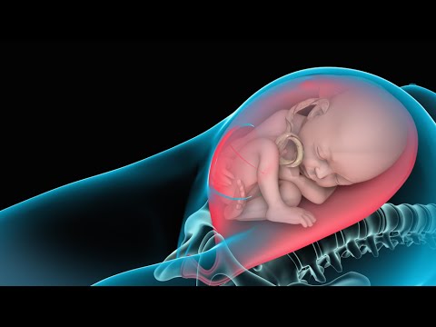 Video: Aborto Dopo Taglio Cesareo: Metodi, Indicazioni E Controindicazioni