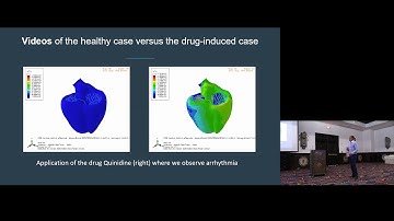 Personalized Healthcare with High Performance Computing in the Cloud