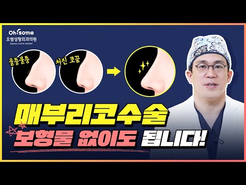 매부리코수술도 무보형물로 할 수 있어요😎│매부리코 유형과 수술 방법의 차이!
