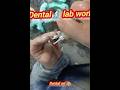 metal ceramic work on #anime #shortsfeed #music #song #dentist