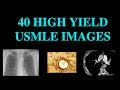 40 High Yield Images for USMLE (CT, XRay, Histology)