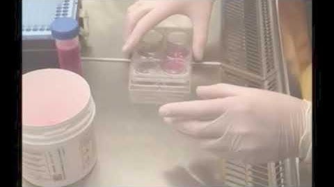 Lung co-culture models