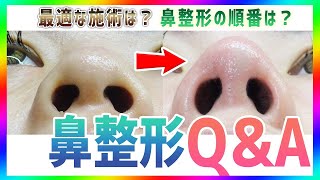 【鼻整形Q&A】理想の鼻になる為の最適な施術は？プロが鼻整形の質問に回答！【質問コーナー】