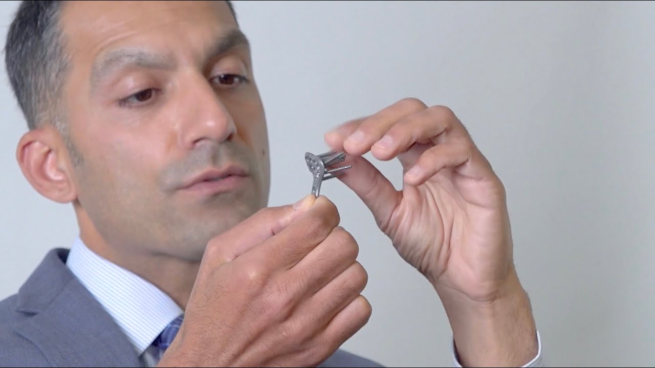 Wrist Fracture Repair & Locking Plate Technology - Dr Khurram Pervaiz