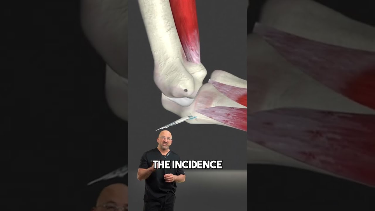 Tommy John Elbow Surgery Faster Pitching Elbowsurgery Tommyjohn Baseballinjury