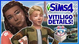 FREE Vitiligo Skin Details! | Sims Delivery Express (Feb 13, 2024)