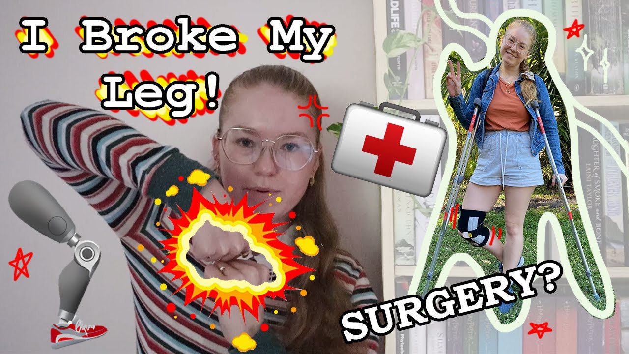 I Broke My Leg! 😭 Storytime...Again