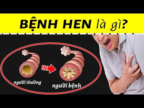 Video: Mèo Có Thể Bị Hen Suyễn Không?