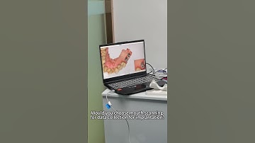 Would you choose mouth scanning for data collection for implantation? #dental #youtube