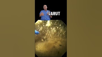 Thumbnail of Pecahin batu dengan laser, ga bahaya ta?!! #batuginjal #ginjal #healthinfo #urologi #dokter
