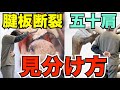 【間違うと逆効果】五十肩と腱板断裂の違いと治し方