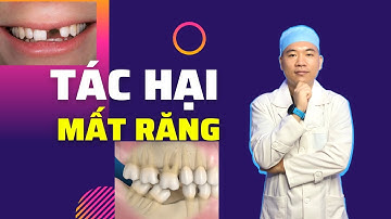 Tác hại của mất răng có nên làm răng giả không - Nha khoa Smile HT chia sẻ khắc phục khi mất răng