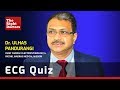 ECG Quiz | Dr. Ulhas Pundurangi