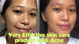 From Head to Toe skin care products na subrang effective, sikat to sa tiktok