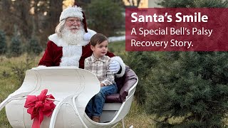 Santa Gets His Smile Back: How Jeffrey Schott Recovered from Facial Paralysis - Penn State Health