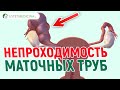 ГИДРОСАПИНКС (непроходимость) маточных труб. Причины, анализы, лечение. ГСГ маточных труб.