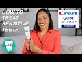 How to treat SENSITIVE TEETH | Crest Gum Detoxify Toothpaste