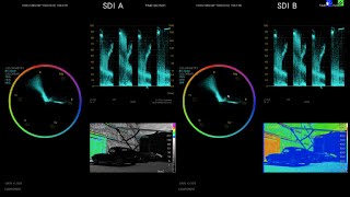 Leader Scopes On Set Production Guide Camera Matching