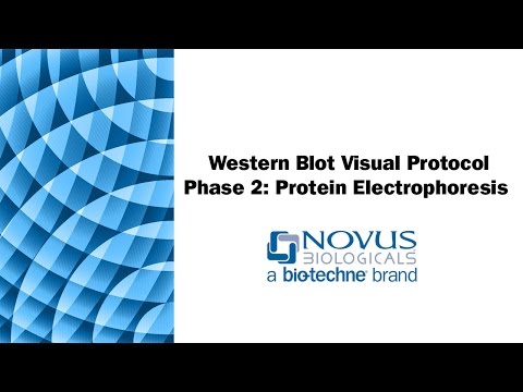 Western Blot Visual Protocol: Phase 2: Protein Electrophoresis (SDS-PAGE)