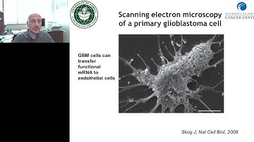 MicroRNAs in Extracellular Vesicles orchestrate the biology of the Tumor Microenvironment