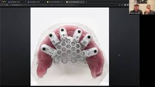 The Workflow: Digital Full Arch Implants