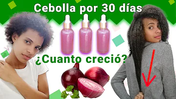 ¿Qué cebolla es mejor para el crecimiento del cabello?