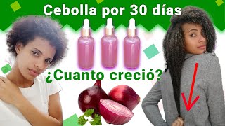 JUGO DE CEBOLLA  para el CRECIMIENTO DEL CABELLO😱 ANTES Y DESPUÉS. Funciona?🤔