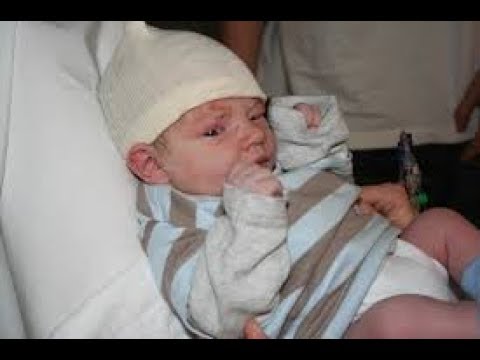 Syphilis in Babies: Old Disease Makes A Comeback - YouTube
