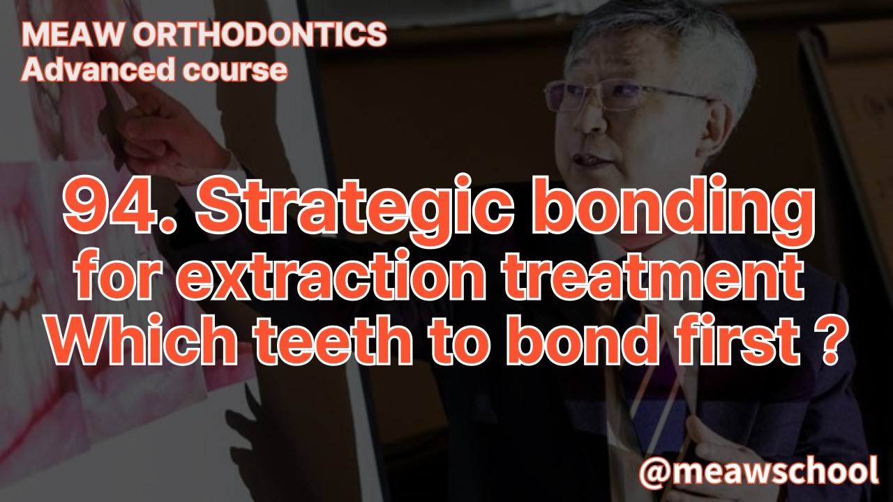 94.Strategic bonding for extraction treatment - Which teeth to bond first?