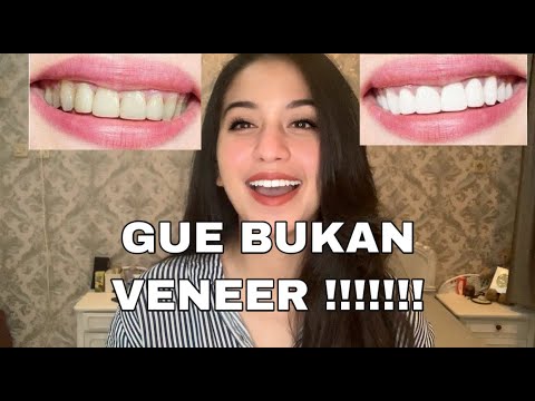 Video: Senyum Lebih Cerah Dengan Produk Pemutih Gigi Terbaik