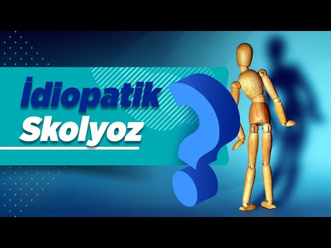 İdiopatik Skolyoz Nedir? İnfantil Jüvenil Adölesan İdiopatik Skolyoz Tedavisi ve Ameliyatı