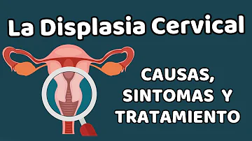 ¿Es frecuente la displasia cervical?