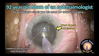 CataractCoach 1430: mom of an ophthalmologist has cataract surgery