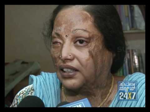 SUVARNA NEWS - CRIME REPORTER - ACID ATTACK ON SHRUTHI -SEG-3