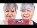 Julies dental implant smile makeover journey  dental boutique
