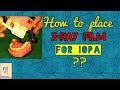 Dental x ray film Placement | position of x ray film to take intra oral periapical radiograph | IOPA