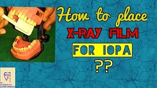 Dental x ray film Placement | position of x ray film to take intra oral periapical radiograph | IOPA