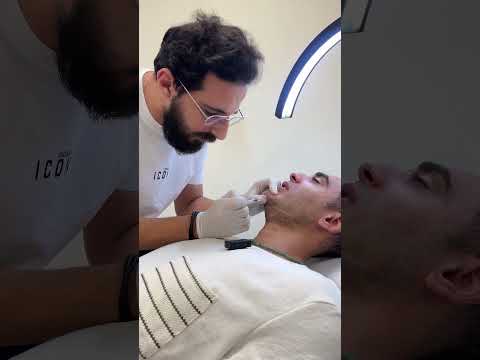 تجربتي مع تعريض الفك تكساس و ال 