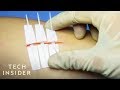 Needle-Less Alternative To Stitches