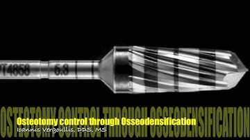 Osteotomy control through Osseodensification