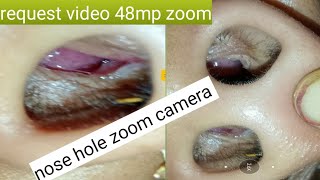 #nose hole zoom camera request video