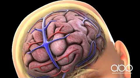 Concussion and Bleeding On The Brain - DayDayNews
