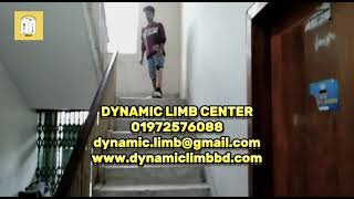 Revolutionizing Lives With Advanced Artificial Limbs Dynamic Limb Center