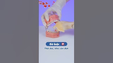 Niềng răng không nên ăn gì ngày Tết? | Lạc Việt Intech Niềng Răng #shorts