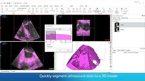 Ultrasound Clearance | Mimics Innovation Suite 24