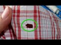 Amazingly Recycle Hole On Shirt / Fix Your Clothes By Yourself