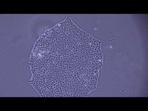 Assessing iPSC Morphology