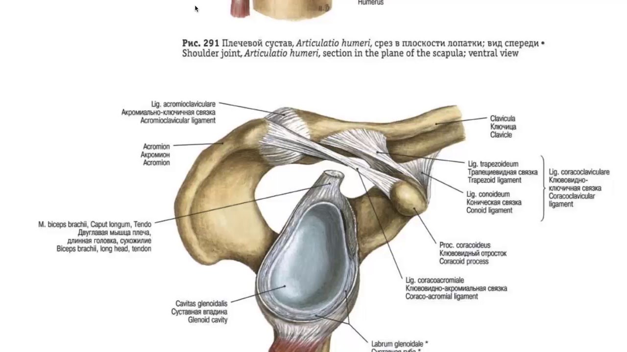 Плечевая губа суставная разрыв. Фиброзно-хрящевая губа гленоида. Суставная фиброзно-хрящевая губа гленоида. Гленоид плечевого сустава анатомия. Хрящевая губа плечевого сустава анатомия.