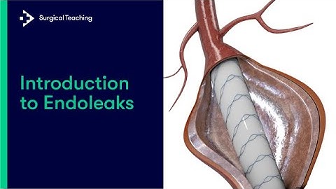 Introduction to Endoleaks  | What Every Medical Student Needs to Know